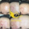 FREESHIP 50K Serum Turmeric Giảm Mụn Thâm Rỗ 72h Giá chỉ 405k Mỹ phẩm Thế Giới 3