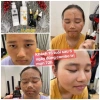 FREESHIP 50K Serum Turmeric Giảm Mụn Thâm Rỗ 72h Giá chỉ 405k Mỹ phẩm Thế Giới 5