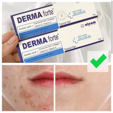 Gamma Derma Forte Kem Mờ Thâm Mụn 15g - Giảm Sưng Đỏ, Dưỡng Da, Giá 90.000