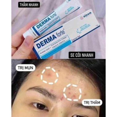 Gamma Derma Forte Kem Mờ Thâm Mụn 15g - Giảm Sưng Đỏ, Dưỡng Da, Giá 90.000 4 Gamma Derma Forte Kem Mờ Thâm Mụn 15g - Giảm Sưng Đỏ, Dưỡng Da, Giá 90.000 4