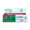 Gel Acnes Sealing Jell 18g - Giảm Mụn Đầu Đen, Đầu Trắng, Hiệu Quả, Giá 78.000 9