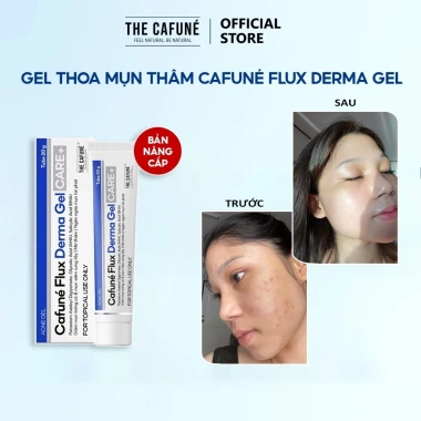 Gel chấm Mụn Thâm Cafuné Flux Derma Essence - Giảm Mụn, Mờ Thâm, Ngừa Mụn cho mọi loại da, giảm còn 119.000₫ 6