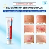 Gel DERMATIDEM PLUS 20g - Giảm mụn, mờ thâm nhanh, khô cồi, trị mụn viêm và ẩn, chỉ 140.000đ