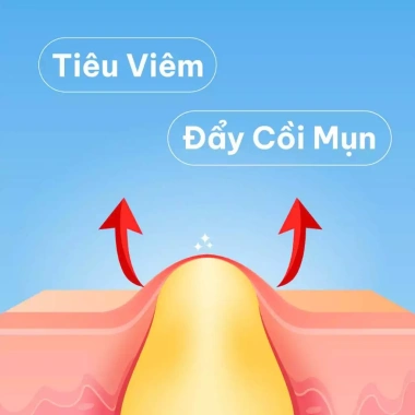 Gel DERMATIDEM PLUS 20g - Giảm mụn, mờ thâm nhanh, khô cồi, trị mụn viêm và ẩn, chỉ 140.000đ 5