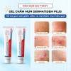 Gel DERMATIDEM PLUS 20g - Giảm mụn, mờ thâm nhanh, khô cồi, trị mụn viêm và ẩn, chỉ 140.000đ 9