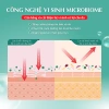 Gel dưỡng ẩm Hada Labo Acne Care Calming Gel Cream 50g - Dành cho da mụn nhạy cảm, giảm sưng, giá ưu đãi 239.000đ 4