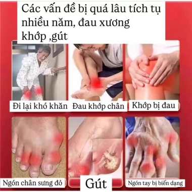 Gel Hồng Ngoại MITSUI Giảm Đau Gút, Đau Xương Khớp - Giá 38.994 VND Bảo Quý