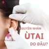 Gel Mỡ Thảo Mộc Tiêu Biến Ư Tai Nhật Bản - Bỏ tiếng ù, giảm áp lực, ngừa điếc | YD Pharm 99k 5