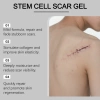 Gel sẹo Nha Đam Collagen Thủy Phân - Dưỡng ẩm, Sửa, Giảm tăng sắc tố 3