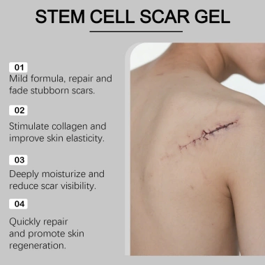 Gel sẹo Nha Đam Collagen Thủy Phân - Dưỡng ẩm, Sửa, Giảm tăng sắc tố 3