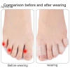 Gel Silicon Ngón Chân Aqtocna - Bảo Vệ Ống Ngón, Ngăn Vỉ, Chống Sương Mù, Thoáng Khí 6