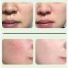 Gel Tẩy Da Chết Mặt Ginbi Chiết Xuất Nha Đam – Da Sạch Mịn, Căng Bóng, Giá Chỉ 90.000₫ 7