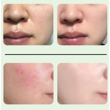 Gel Tẩy Da Chết Mặt Ginbi Chiết Xuất Nha Đam – Da Sạch Mịn, Căng Bóng, Giá Chỉ 90.000₫ 7