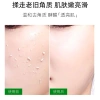 Gel tẩy tế bào chết ADQ BOM 100g - Dưỡng da tươi trẻ trắng sáng lô hội tự nhiên A258 - 19.900 VND 5