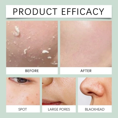 Gel Tẩy Tế Bào Chết Chiết Xuất Thảo Dược 50g - Da Phát Sáng Nhẹ Nhàng, Giá Ưu Đãi 58.299₫