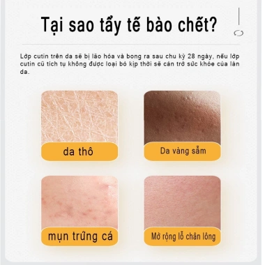 Gel tẩy tế bào chết mặt Đường Vàng – Làm sạch sâu, giảm mụn đầu đen, da mềm trắng, dưỡng ẩm toàn thân 142k 2