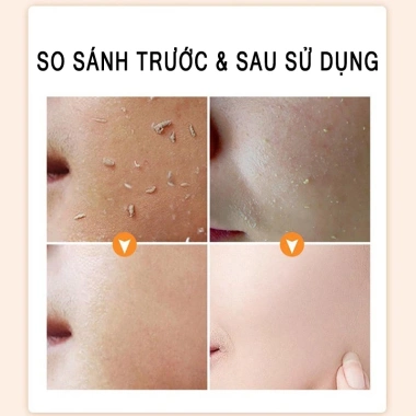 Gel tẩy tế bào chết mặt Đường Vàng – Làm sạch sâu, giảm mụn đầu đen, da mềm trắng, dưỡng ẩm toàn thân 142k 4