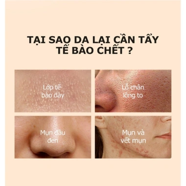 Gel Tẩy Tế Bào Chết PIAC Enzyme Cam - Da Sáng Mịn, Làm Sạch Dịu Nhẹ, 49.800₫