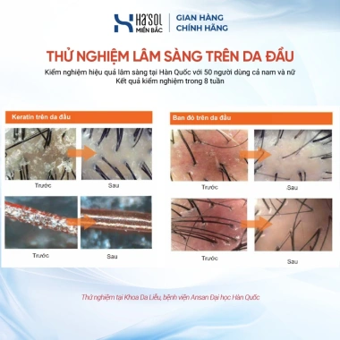 Giải pháp phục hồi tóc Hasol: Dầu gội cam Volume 500g + Kem ủ tóc, ngăn rụng, tóc dày tự nhiên – 850.000đ 2