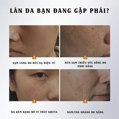 Giảm thâm nám chính hãng Vitamin C + Niacinamide 9% – Dưỡng sáng da nhạy cảm 100ml – 187k