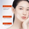 Giảm thâm nám chính hãng Vitamin C + Niacinamide 9% – Dưỡng sáng da nhạy cảm 100ml – 187k 4