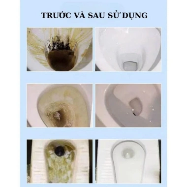 GLIT Xịt Tẩy Rửa Bồn Cầu và Phòng Tắm Hương Nhài - Làm Sạch Tức Thì, Diệt Khuẩn, Loại Mùi Hôi, 139.000₫ 6