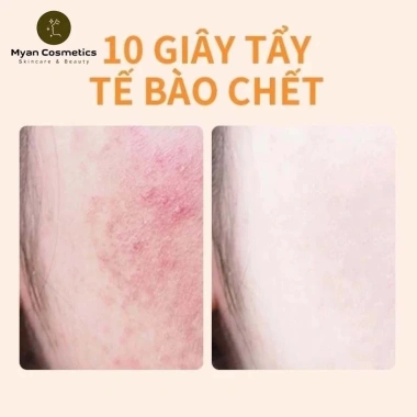 GMEELAN Gel Tẩy Tế Bào Chết Enzymes Cam 50g - Da Mặt Sáng Mịn, Giá chỉ 85.000₫