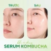 Herbloom Serum Thuần Chay 50ml Cấp Ẩm Sâu Dưỡng Trắng Chống Lão Hoá Kombucha Plant Biome - Giá ưu đãi 699.000đ 7