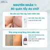 Heshi Nature Peeling Gel Tẩy Da Chết 12/2.026 – Giải Pháp Da Sáng Mịn, Giá 199k 6