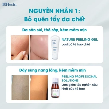 Heshi Nature Peeling Gel Tẩy Da Chết 12/2.026 – Giải Pháp Da Sáng Mịn, Giá 199k 6 Heshi Nature Peeling Gel Tẩy Da Chết 12/2.026 – Giải Pháp Da Sáng Mịn, Giá 199k 6