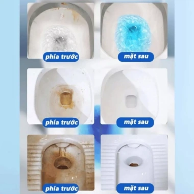 Homix Cốc Thả Bồn Cầu Khử Mùi, Diệt Khuẩn, Trắng Sáng, Tiết Kiệm Thời Gian Rửa 4