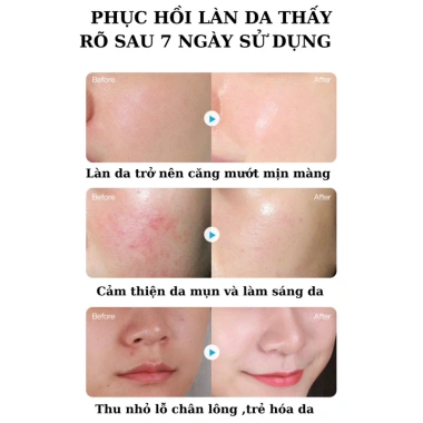 Hộp 10 miếng mặt nạ B5 O'gulia - Phục hồi, cấp ẩm, trắng da, trẻ hóa, mềm mịn - Chỉ 25.000đ