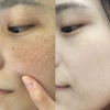 Hộp 10 Ống 377 Tinh Chất Kem Niacinamide - Làm Trắng Da, Chống Tàn Nhang, Cải Thiện Xỉn Màu - 28.000 VND 5