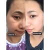 Hộp 10 Ống 377 Tinh Chất Kem Niacinamide - Làm Trắng Da, Chống Tàn Nhang, Cải Thiện Xỉn Màu - 28.000 VND 7