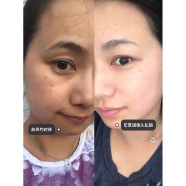 Hộp 10 Ống 377 Tinh Chất Kem Niacinamide - Làm Trắng Da, Chống Tàn Nhang, Cải Thiện Xỉn Màu - 28.000 VND 7