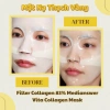 Hộp 5 miếng Mặt Nạ Thạch Collagen 83% Pure – Tái tạo da, chống lão hoá, trắng sáng, giá chỉ 346.000₫ 2