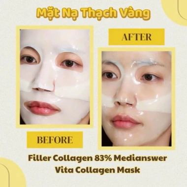 Hộp 5 miếng Mặt Nạ Thạch Collagen 83% Pure – Tái tạo da, chống lão hoá, trắng sáng, giá chỉ 346.000₫