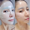 Hộp 5 miếng Mặt Nạ Thạch Collagen 83% Pure – Tái tạo da, chống lão hoá, trắng sáng, giá chỉ 346.000₫ 9