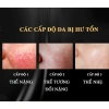 Hot Kem Mao Mạch Baby Milk 20g – Phục Hồi Da Đỏ Nhiễm Corticoid, Hàng Hiệu Cao Thiên Nhi, Giá 550k 2