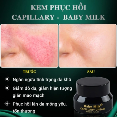 Hot Kem Mao Mạch Baby Milk 20g – Phục Hồi Da Đỏ Nhiễm Corticoid, Hàng Hiệu Cao Thiên Nhi, Giá 550k 3