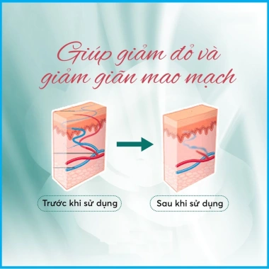 Jean D'Arcel Couperose Cream - Kem dưỡng da nhạy cảm giảm đỏ, giãn tĩnh mạch, chỉ 720.000đ