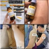 Kela Lotion 30ml Dưỡng ẩm và Se Khít Lỗ Chân Lông, Giảm Viêm Lỗ, Giá 269.000 VND - Giảm Giá Đặc Biệt