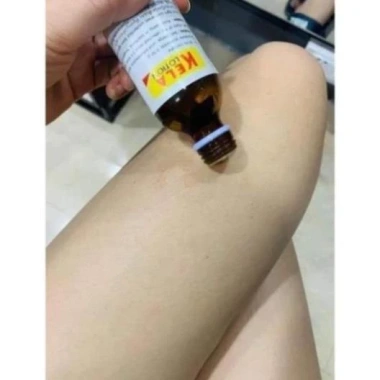 Kela Lotion 30ml Dưỡng ẩm và Se Khít Lỗ Chân Lông, Giảm Viêm Lỗ, Giá 269.000 VND - Giảm Giá Đặc Biệt
