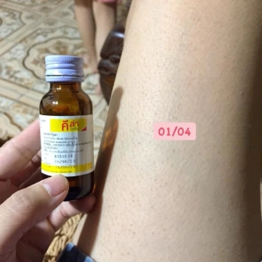 Kela Lotion 30ml Dưỡng ẩm và Se Khít Lỗ Chân Lông, Giảm Viêm Lỗ, Giá 269.000 VND - Giảm Giá Đặc Biệt
