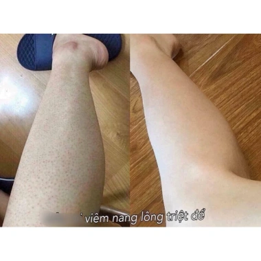 Kela Lotion Vitamin C làm sáng da, se khít lỗ chân lông, 60ml - Chỉ 238.000₫ 4