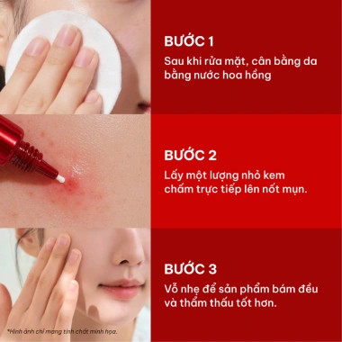 Kem 17Hours Red Spot Cream 15g - Aczero, 4‑Terpinoel, Tea Tree Oil, làm dịu da, da mịn, 368.500₫ 8 Kem 17Hours Red Spot Cream 15g - Aczero, 4‑Terpinoel, Tea Tree Oil, làm dịu da, da mịn, 368.500₫ 8
