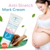 Kem Anti-stretch Marks 57k - Làm mờ rạn da, sẹo, thâm, nhăn hiệu quả