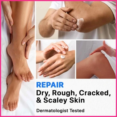 Kem Axit Salicylic 2 Khuỷu Tay 40% Urea – Xóa Vết Chai Sần, Dưỡng Cơ Thể Nứt Nẻ, Giá chỉ 83.600đ