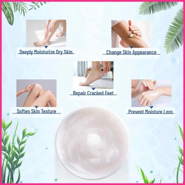 Kem Axit Salicylic 2 Khuỷu Tay 40% Urea – Xóa Vết Chai Sần, Dưỡng Cơ Thể Nứt Nẻ, Giá chỉ 83.600đ