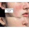 Kem B5 Prettyskin 1.5ml Mini - Dưỡng ẩm, phục hồi dịu da, giảm giá 22% chỉ 45.000 VND 6